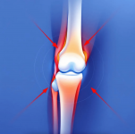 arthritis2-min.png
