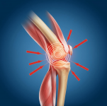 arthritis2-2-min.png