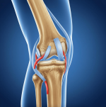 arthritis4-min.png