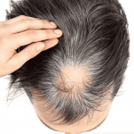 hair2-1.png